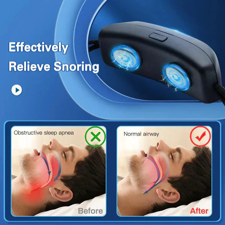 Discreet adult anti-snoring device, comfortable for quiet, peaceful & restful sleep.