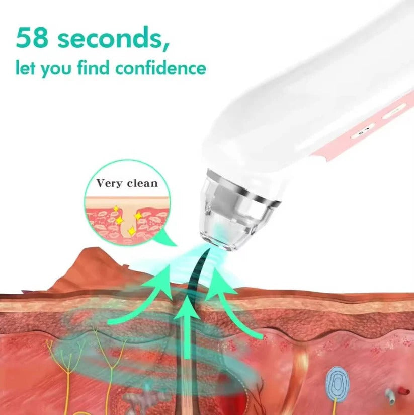 Rechargeable smart blackhead remover & acne extractor. Features 1080P camera for clear skin care.