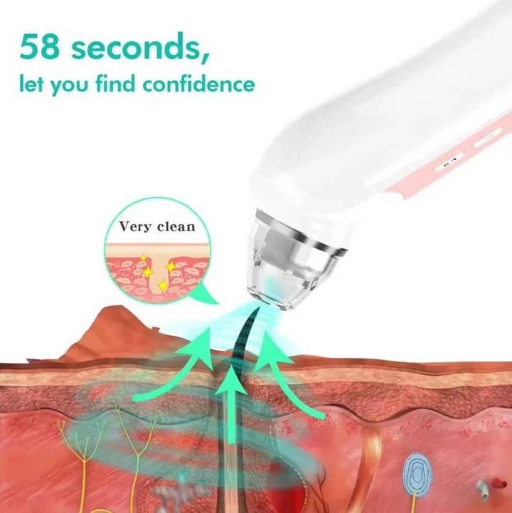 Rechargeable smart blackhead remover & acne extractor. Features 1080P camera for clear skin care.