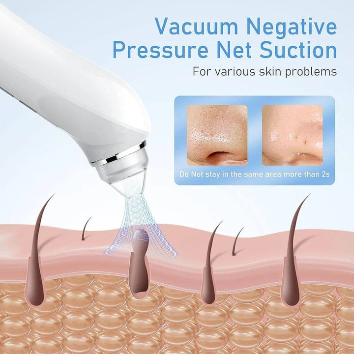 Beauty tool: Smart blackhead remover with 1080P camera. Offers deep cleaning & effective acne extraction.