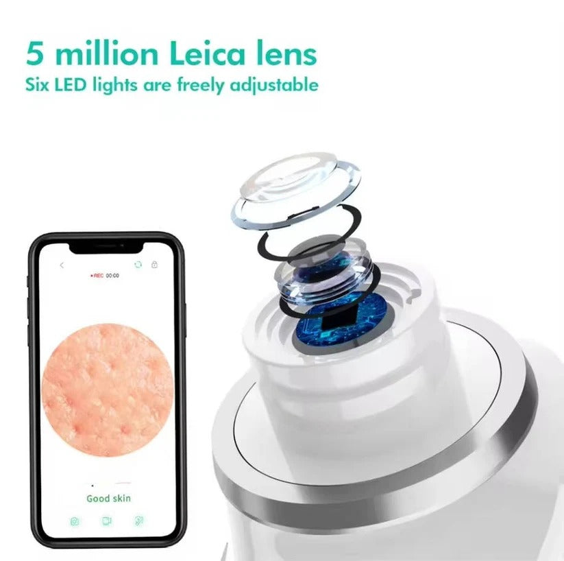 Portable smart blackhead remover, rechargeable, with 1080P camera for guided skin care & pore cleaning.