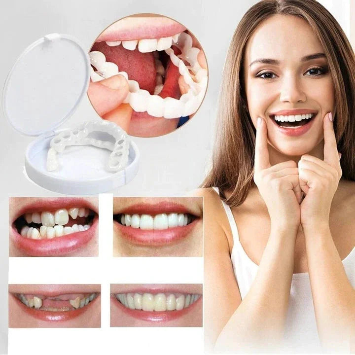 Instant Natural Smile Veneers for upper & lower teeth. Achieve a perfect smile makeover effortlessly.