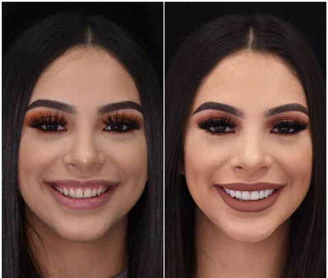 Removable Instant Natural Smile Veneers for upper & lower teeth. A convenient temporary dental solution.